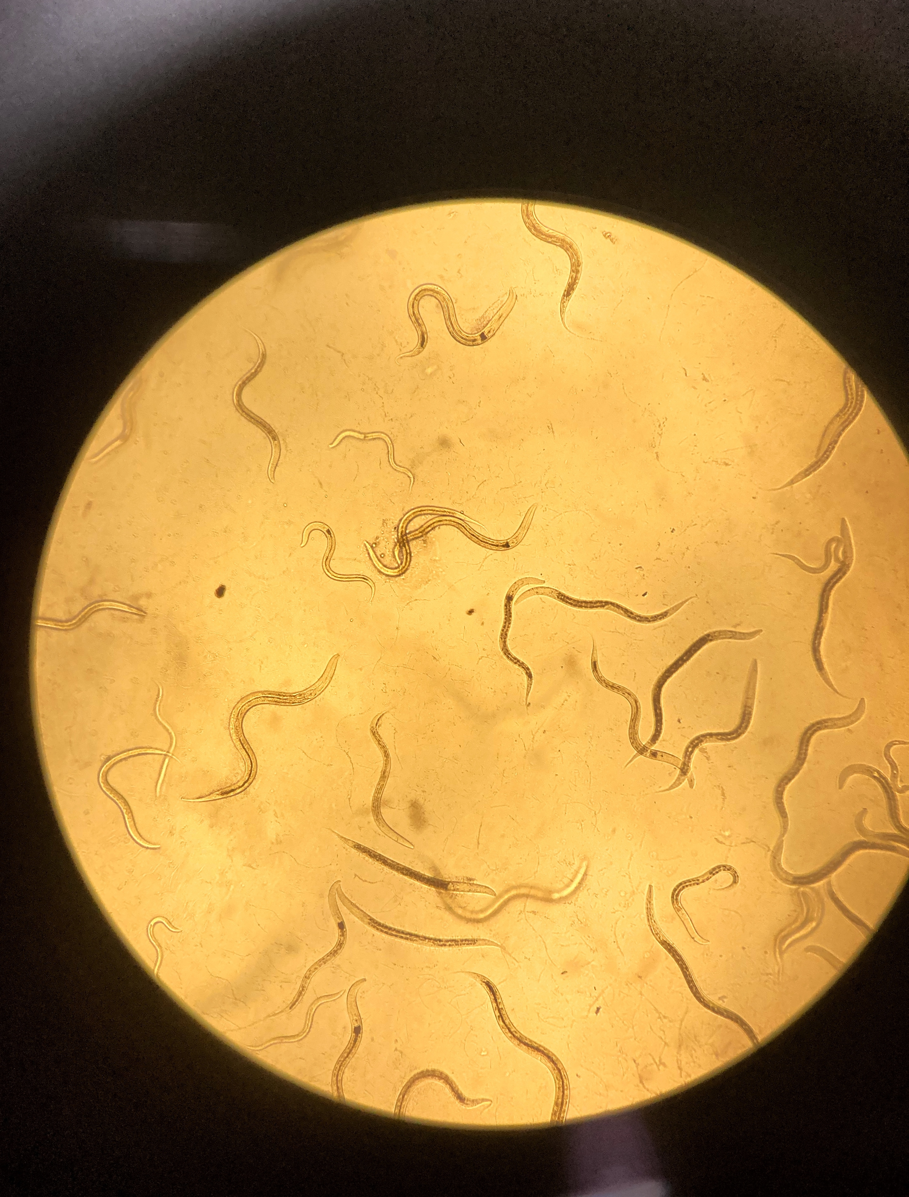 C. elegans under fluorescent microscope